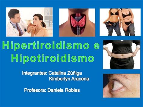 Hipotiroidismo E Hipertiroidismo Ppt