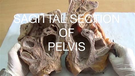 Sagittal Pelvic Anatomy