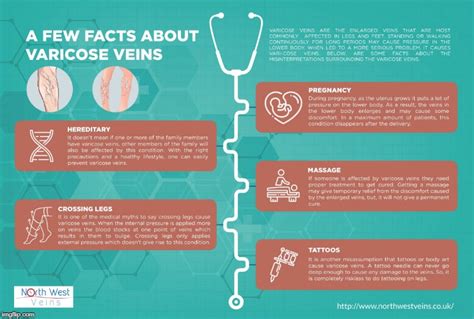 Image Tagged In A Few Facts About Varicose Veins Imgflip