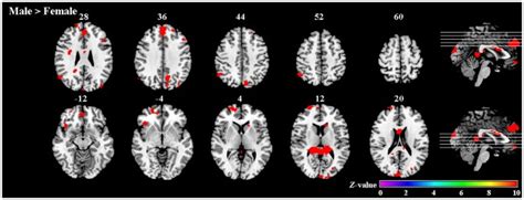 Cognition Emotion And Reward Networks Associated With Sex Differences