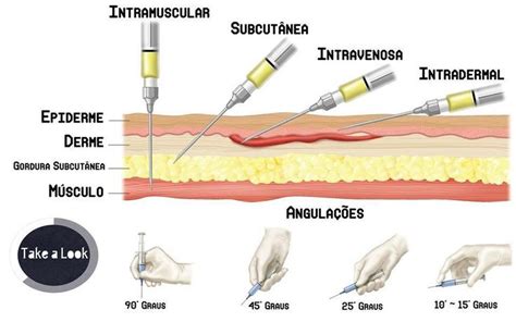 Básicamente Existen Cuatro Tipos De Inyección Intramuscular