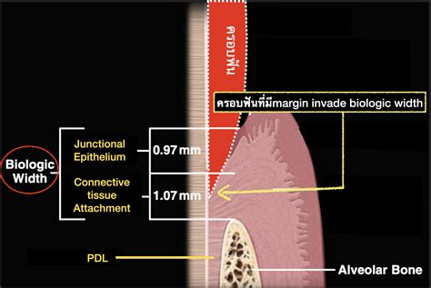 What is biologic width?