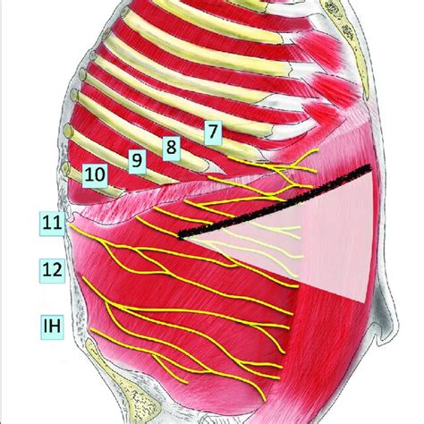 Different Types Of Incisions Used In Hpb Surgery A Lines Of