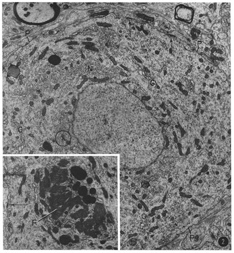 FIGURE Purkinje Cell The Nucleus Is Surrouned By A Thick Band Of