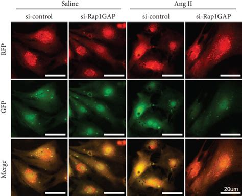 Rap Gap Knockdown Attenuates Cardiomyocyte Hypertrophy And Enhanced Ang