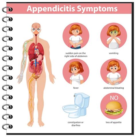 Schematic Diagram Of Appendicitis Pain Location - Circuit Diagram