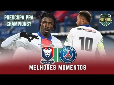 Show De Neym R Caen X Psg Melhores Momentos Copa Da Fran A