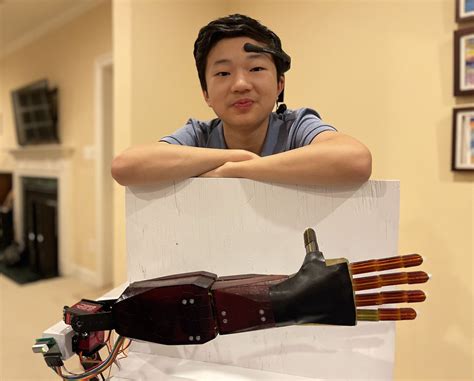 A High School Student Invented An Affordable Brain-Reading Prosthetic