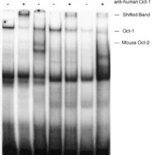 An Assay Demonstrating The Octamer Binding Protein Patterns For