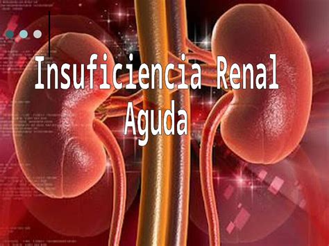 PPT Insuficiencia Renal Aguda DOKUMEN TIPS