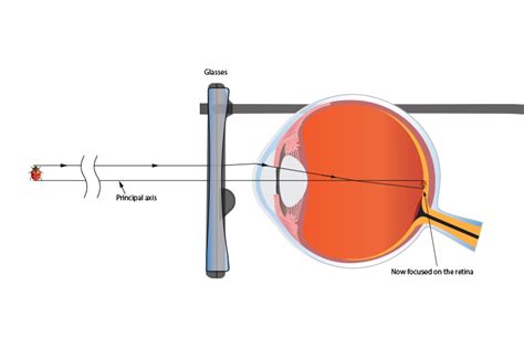 Concave Lens Use Glasses