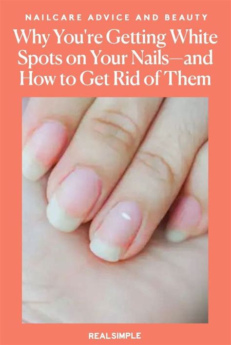 We Asked Experts What Do White Spots On Nails Mean What Causes White