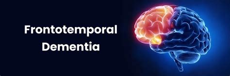 What Are The Symptoms Of Frontotemporal Dementia