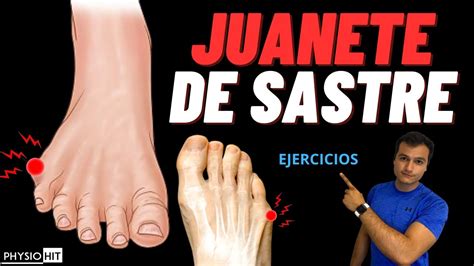 Juanete De Sastre Ejercicios Fisioterapia Y Rehabilitaci N Youtube