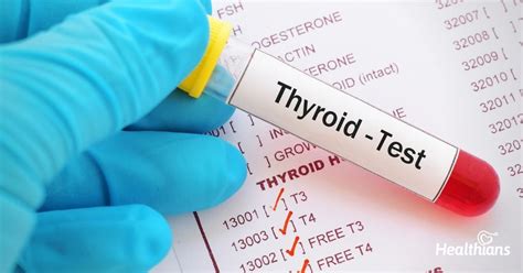 Thyroid test – T3, T4 & TSH (Free & Total) - HEALTHIANS BLOG