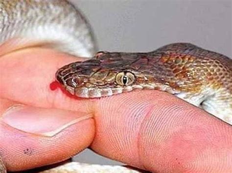 Saanp Ke Katne Par Kya Karen Snake Bite First Aid Treatment Home