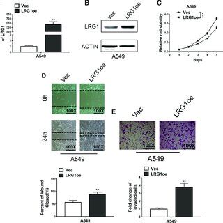 LRG1 Overexpression Promoted Proliferation Migration And Invasion In