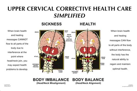 Suffering From An Upper Cervical Misalignment Koru Chiropractic