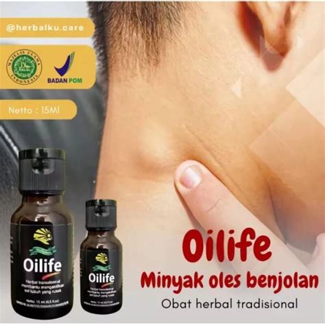 OILIFE ASLI ORIGINAL OBAT BENJOLAN AMPUH TUMOR OBAT HERBAL TUMOR JINAK