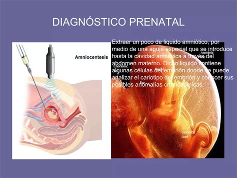 Prevención De Enfermedades Hereditarias Ppt Descarga Gratuita