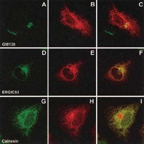 Confocal Immunofluorescence Analysis Of The Intracellular Distribution