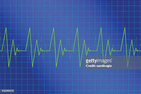 Ecg Graph Paper Photos And Premium High Res Pictures Getty Images