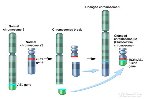 Definition Of BCR ABL Fusion Gene NCI Dictionary Of Cancer Terms NCI