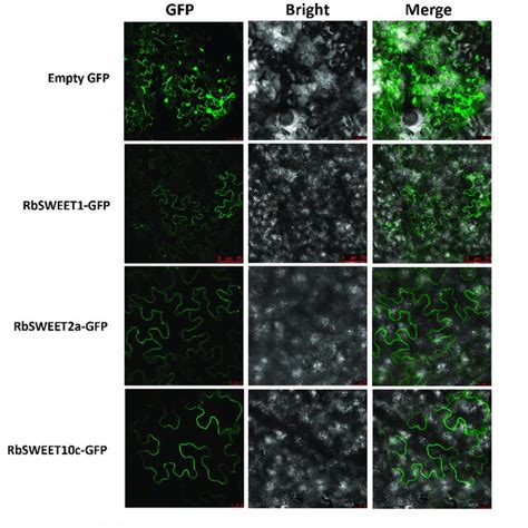 Subcellular Localization Of Rbsweet Gfp Fusion Proteins In Tobacco