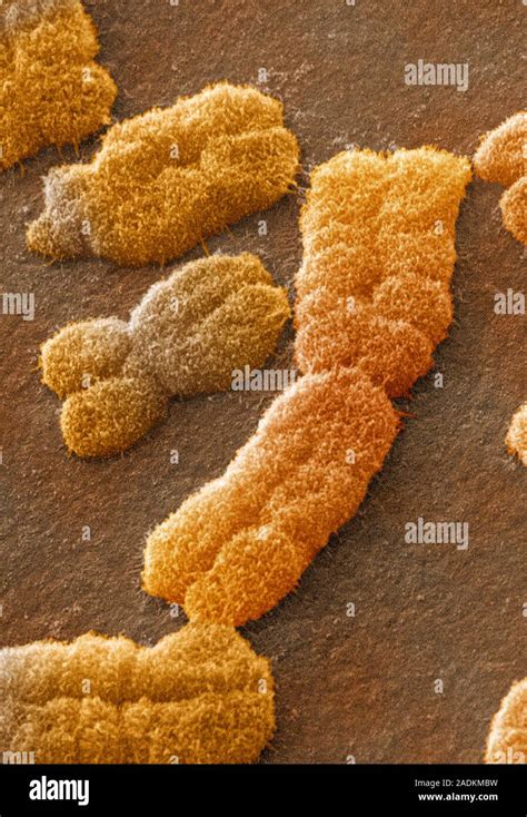 Menschliche Chromosomen Farbige Scanning Electron Micrograph Sem