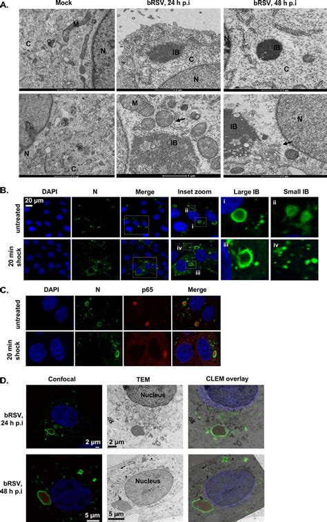 Brsv Ibs Are Membraneless Liquid Organelles A High Power