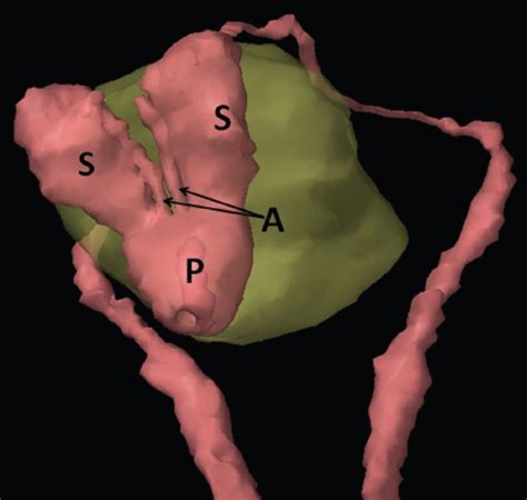 Pelvis And Abdomen Radiology Key