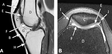 Get A Kick Out Of This The Spectrum Of Knee Extensor Mechanism