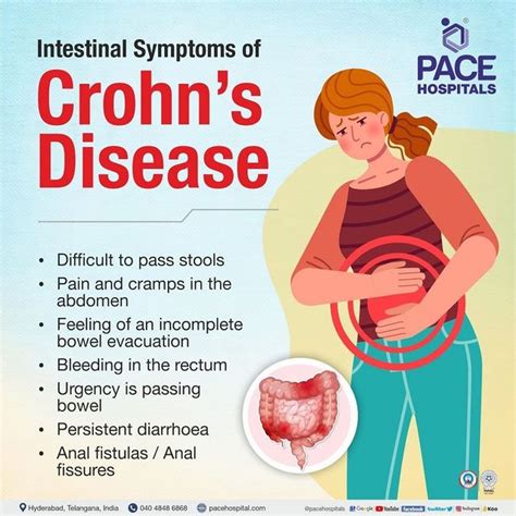 Crohn Disease
