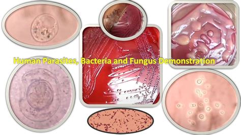 Human Parasites Bacteria And Fungus Demonstration Youtube