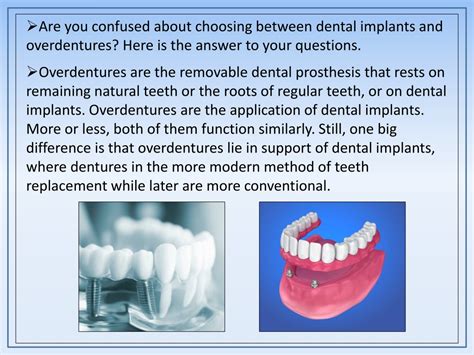 PPT 5 Benefits Of Dental Implant And Overdentures PowerPoint