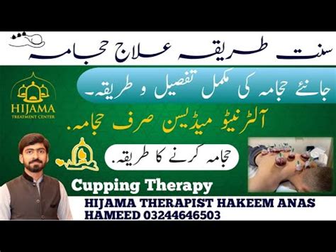 What Is Hijama Hijama Sunnah Points Hijama History In Islam Wet