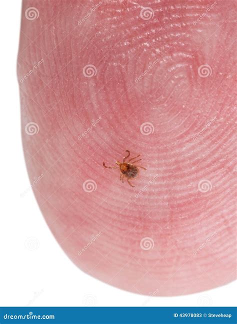 Tiny Deer Tick On Finger Tip Of Man Stock Image Image Of Infectious