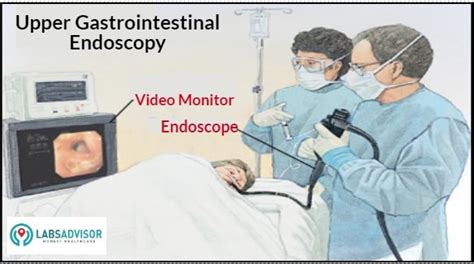 Upto 50% Off on Endoscopy Test Price - Starting ₹4000 only