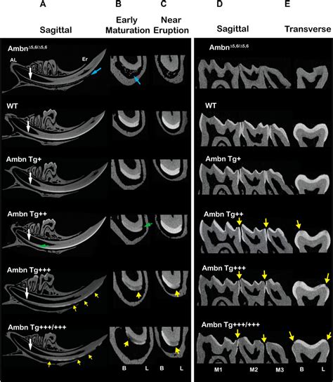 Frontiers Overexpression Of Ameloblastin In Secretory Ameloblasts