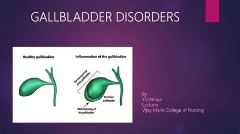 Cholecystitis Ppt