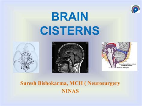 Cisterns Of Brain Ppt