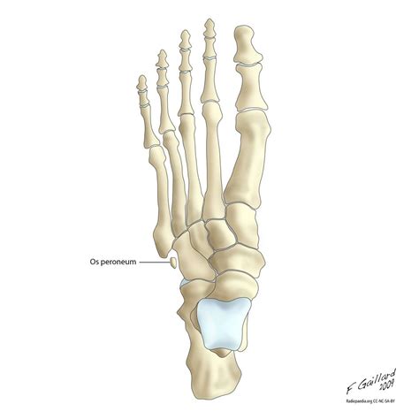 Os Peroneum Radiology Quiz 7643 Medical