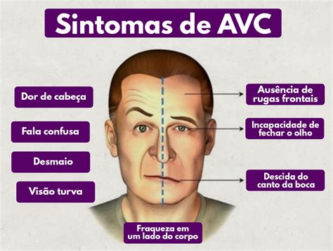 Fique atento aos sinais de AVC Hospital ProntoclínicaHospital