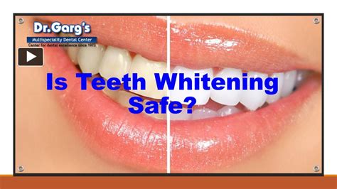 Ppt Is Teeth Whitening Safe Powerpoint Presentation Free To