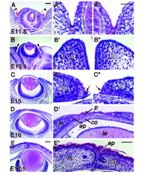 Eyelid Development Of The Mouse At Embryonic Day E A A