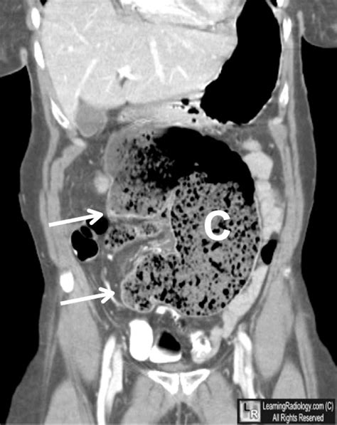 LearningRadiology