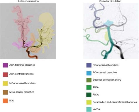 External Carotid Artery Branches Angiogram