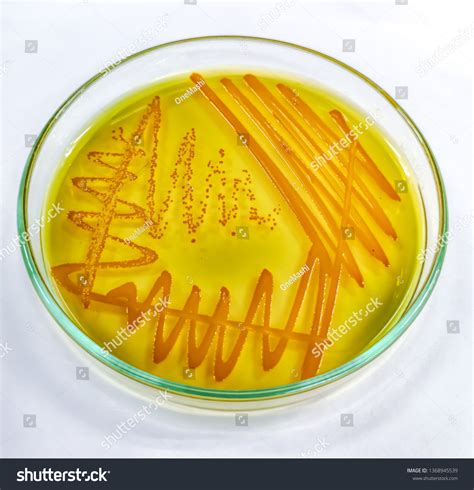 Thiosulfate citrate bile salts sucrose agar 34 รายการ ภาพ ภาพสตอกและ