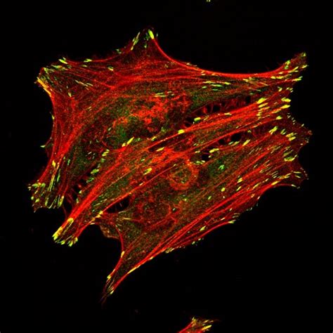 Microscòpia Òptica OM Servei de Microscòpia SM UAB Barcelona