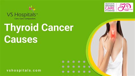 Thyroid Cancer Causes Vs Hospitals 100 Best Care